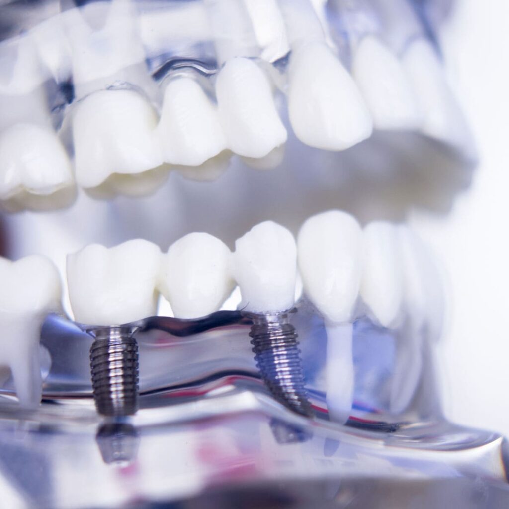 Oral Surgery and Implantology