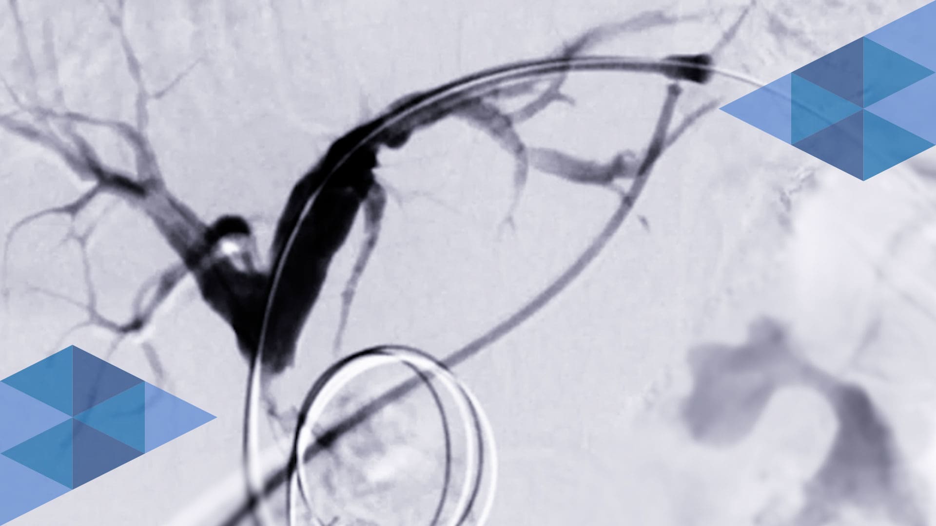 Biliary-Endoscopy-Header